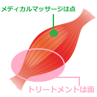 整体とトリートメントのアプローチの違い図解